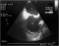 Abbildung 10-b: Postoperative Veränderungen
