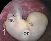 Abbildung 7: Triploider Embryo