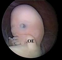 Abbildung 10: Mikrozephaler Embryo