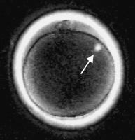 Abbildung 1: Polscopeaufnahme
