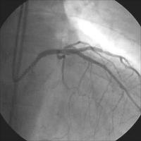 Abbildung 8: Ergebnis nach Crush