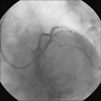 Abbildung 9: Ergebnis nach Crush