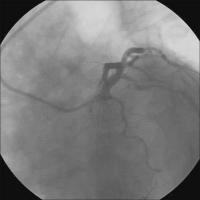 Abbildung 15: Kontrollangiographie