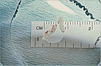 Abbildung 7: Biopsie