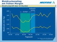Abbildung 9: Morgendlicher Blutdruckanstieg