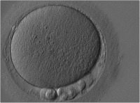 Abbildung 2: Reife Oozyte