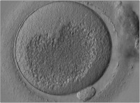 Abbildung 3: MII-Oozyte