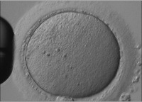 Abbildung 4: Oozyte - reifer Gamet