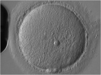 Abbildung 5: Oozyte - refraktiler Körper