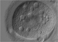 Abbildung 6: Oozyte - Vakuolen