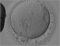 Abbildung 8: Oozyte - Granula