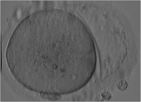 Abbildung 9: Oozyte - Zona pellucida