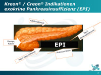 Abbildung 27: Exokrine Pankreasinsuffizienz