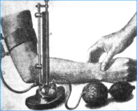 Abbildung 4: Blutdruckmessung