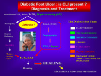 Abbildung 11: Diabetischer Fuß - CLI