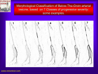 Abbildung 15: Läsion - Klassifikation
