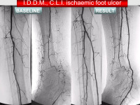 Abbildung 19: Revaskulariasation
