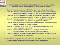 Abbildung 52: Arterielle Läsion - Klassifikation
