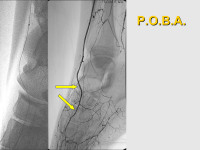 Abbildung 58: P.O.B.A.