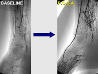 Abbildung 59: P.O.B.A.