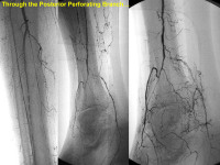 Abbildung 60: P.O.B.A.