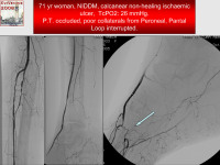 Abbildung 62: P.O.B.A.