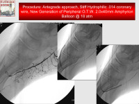 Abbildung 63: P.O.B.A.