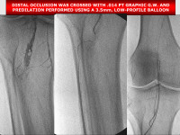 Abbildung 66: P.O.B.A.