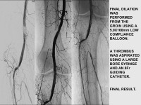 Abbildung 67: P.O.B.A.