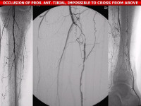 Abbildung 69: P.O.B.A.