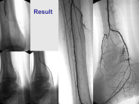 Abbildung 61: P.O.B.A