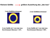 Abbildung 31: Late Loss