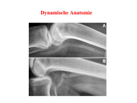 Abbildung 45: Stent - Dynamische Anatomie