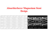 Abbildung 51: Absorbierbarer Magnesium Stent
