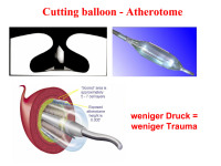 Abbildung 57: Cutting balloon - Atherotome