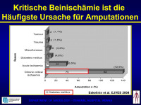 Abbildung 28: Beinischämie