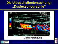 Abbildung 45: Duplexsonographie