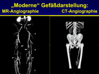 Abbildung 46: Magnetresonanz - Computertomographie