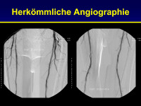 Abbildung 47: Angiographie