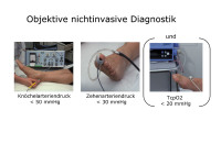 Abbildung 49: Objektive nichtinvasive Diagnostik