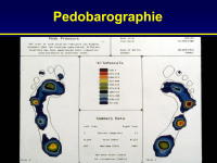 Abbildung 93: Pedobarographie