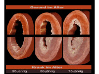 Abbildung 2: Gesundheit - Alter