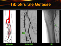 Abbildung 19: Tibiokrurale Gefäße