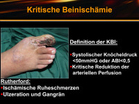 Abbildung 21: Kritische Beinischämie