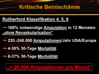 Abbildung 29: Kritische Beinischämie