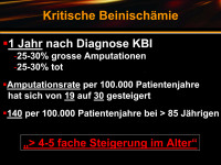 Abbildung 31: Kritische Beinischämie