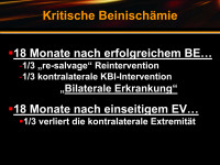 Abbildung 33: Kritische Beinischämie