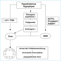 Abbildung 1: Hyperandrogenämie