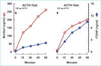 Abbildung 3: ACTH-Test