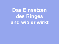 Abbildung 3: Das Einsetzen des Ringes und wie er wirkt